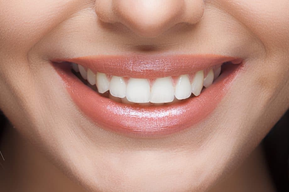 Can You Whiten Your Teeth Too Much? | Golia Dental