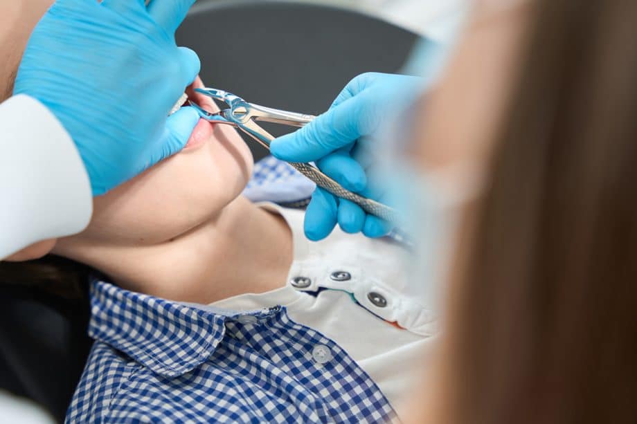 How Do You Stop Bleeding After a Tooth Extraction?