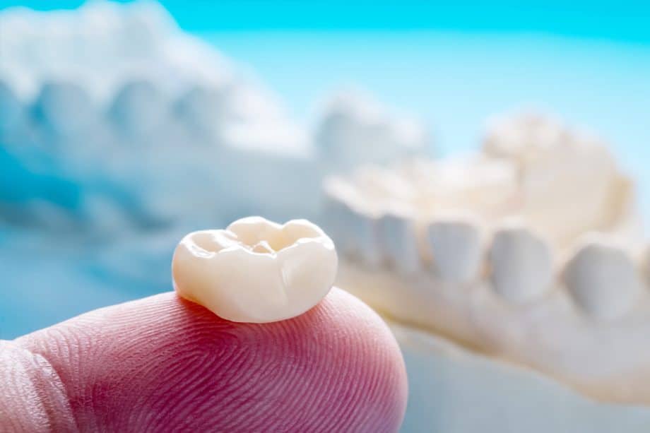 How Long Does It Take To Get A Dental Crown?