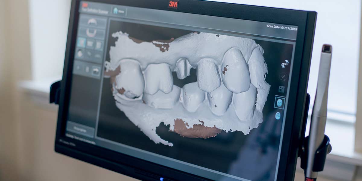 3d Scanner